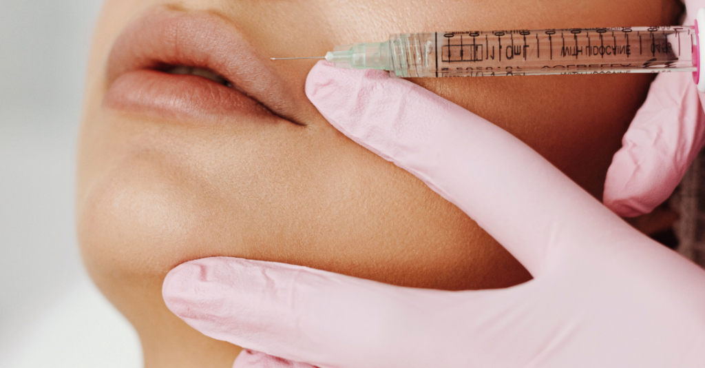 Woman getting dermal filler injected into her lips