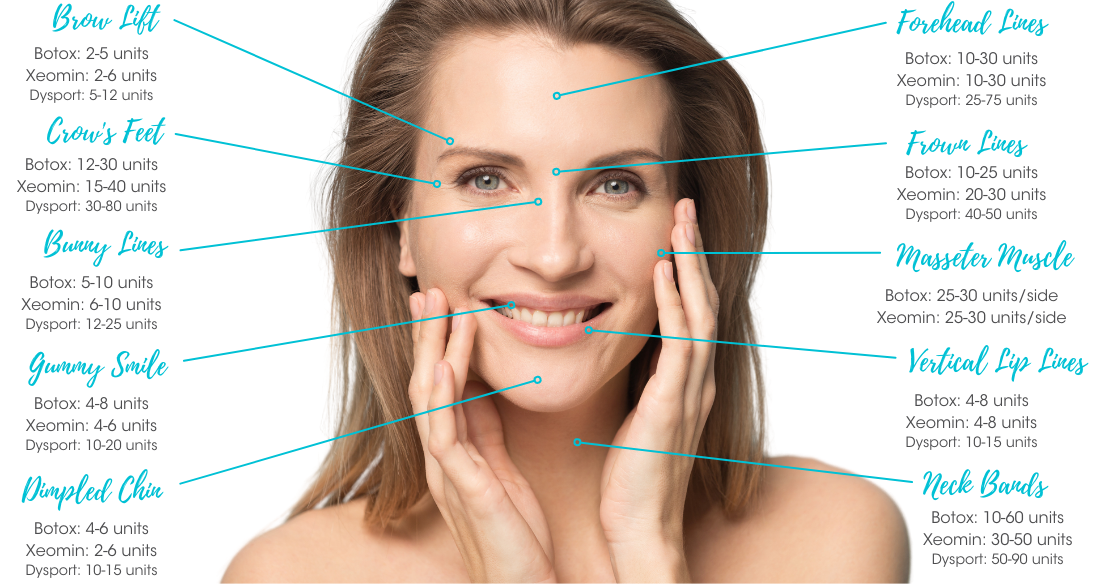 Treatment areas for Botox, xeomin and dysport graphic