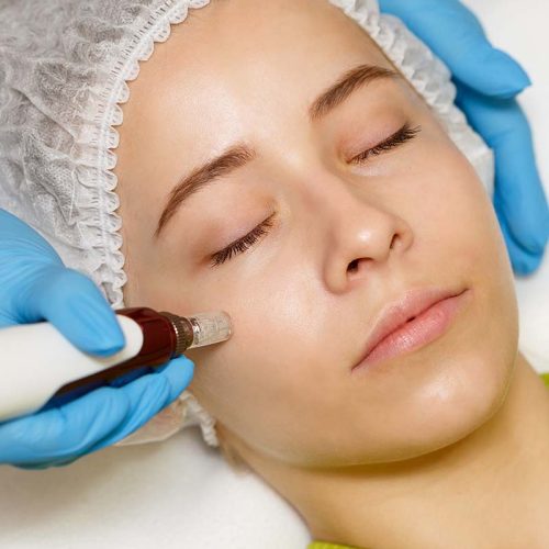 Hardware cosmetology. Mesotherapy. Dermapen. Treatment of cheek zone. Spa treatments. Face rejuvenation.